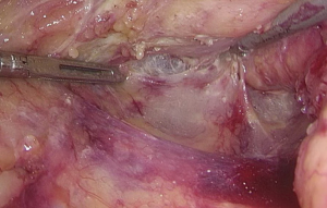 Click on image to zoom