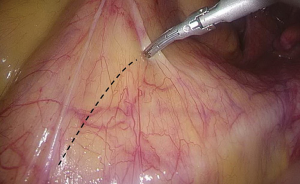 Click on image to zoom