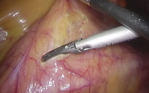 Click on image to zoom