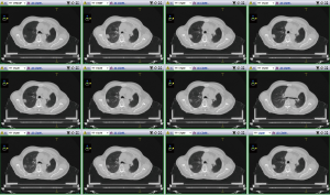 Click on image to zoom