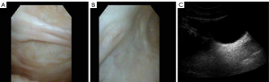 Click on image to zoom