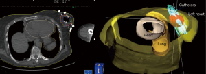 Click on image to zoom