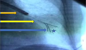 Click on image to zoom