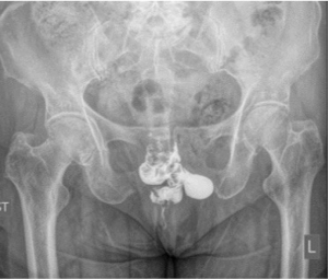 Click on image to zoom