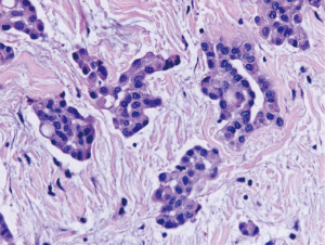 Click on image to zoom