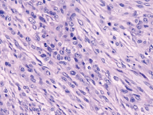 Click on image to zoom