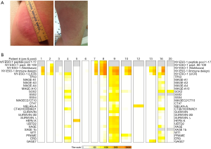 Click on image to zoom