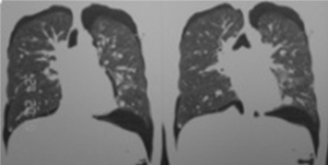 Click on image to zoom Figure 2