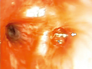 Click on image to zoom