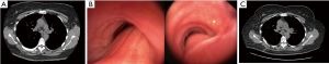Click on image to zoom