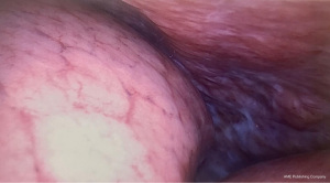 Click on image to zoom