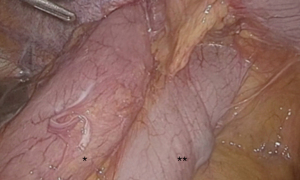 Click on image to zoom