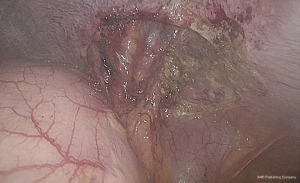 Click on image to zoom