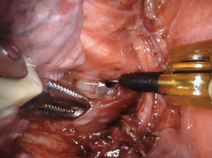 Click on image to zoom