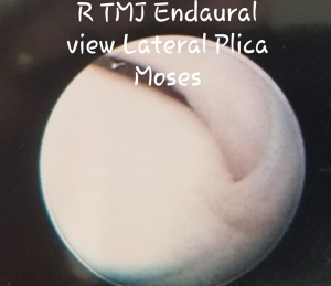 Click on image to zoom