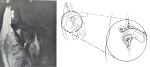 Click on image to zoom
