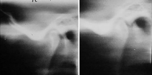 Click on image to zoom