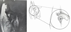 Click on image to zoom