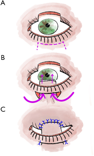 Click on image to zoom