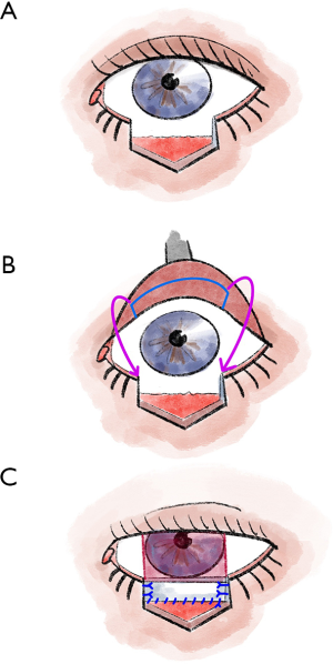 Click on image to zoom
