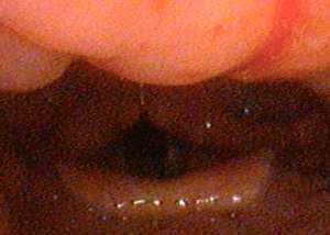 Click on image to zoom