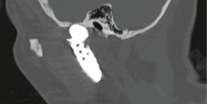 Click on image to zoom