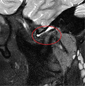Click on image to zoom
