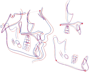 Click on image to zoom