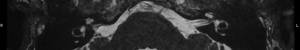 Click on image to zoom