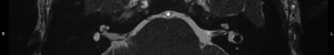 Click on image to zoom