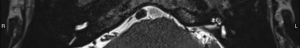 Click on image to zoom