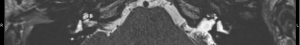 Click on image to zoom