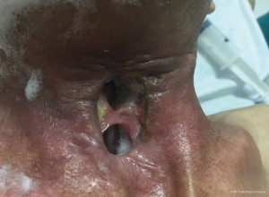 Click on image to zoom