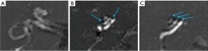 Click on image to zoom
