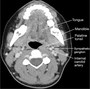 Click on image to zoom