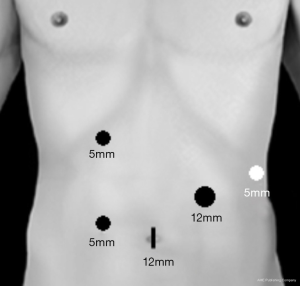 Click on image to zoom