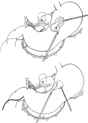 Click on image to zoom