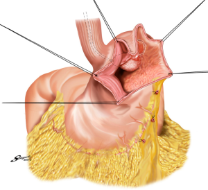 Click on image to zoom