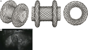 Click on image to zoom