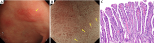 Click on image to zoom
