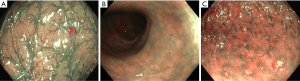 Click on image to zoom