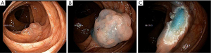 Click on image to zoom
