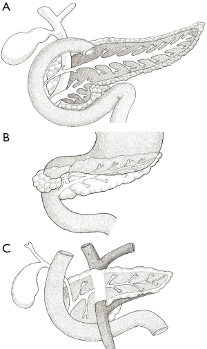 Click on image to zoom