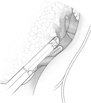 Click on image to zoom