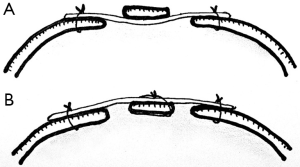 Click on image to zoom