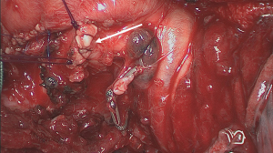 Click on image to zoom