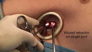 Click on image to zoom