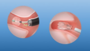 Click on image to zoom