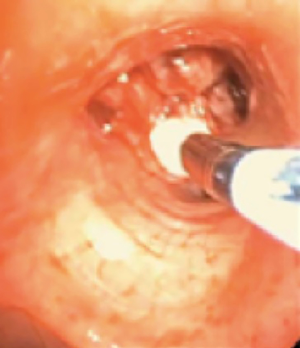 Click on image to zoom