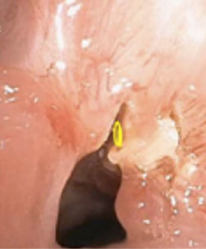 Click on image to zoom